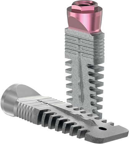 REX IMPLANT