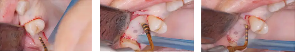 Corso in Live Surgery and Hands-On